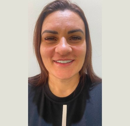 Paciente com sorriso perfeito após tratamento com Lentes de Resina